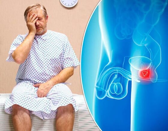 Síntomas de prostatite